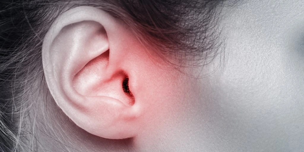 Ear infection  