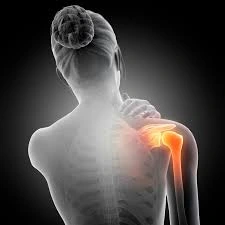 Frozen Shoulder