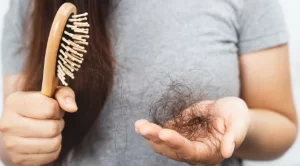 Hair Fall​