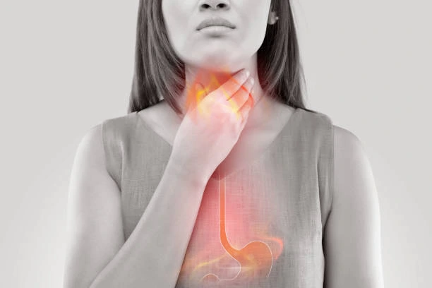 Acid reflux - Throat burning