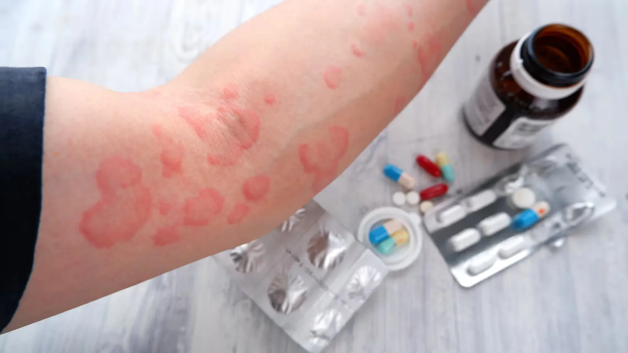 Allergy & Sensitivity