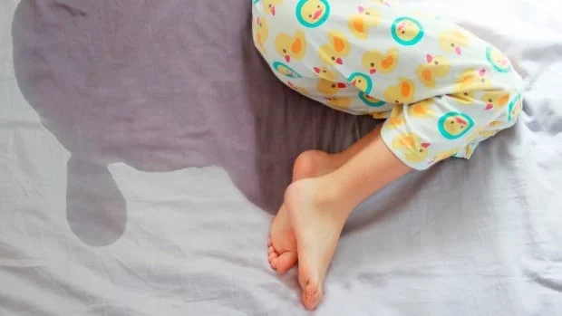 Bedwetting 