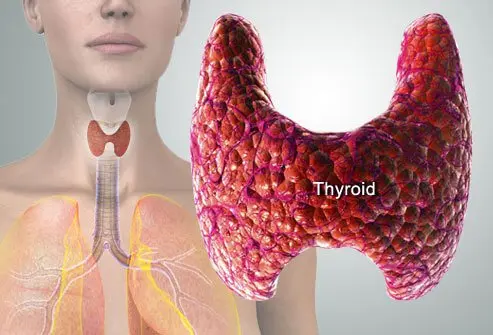 Hypothyrodism   