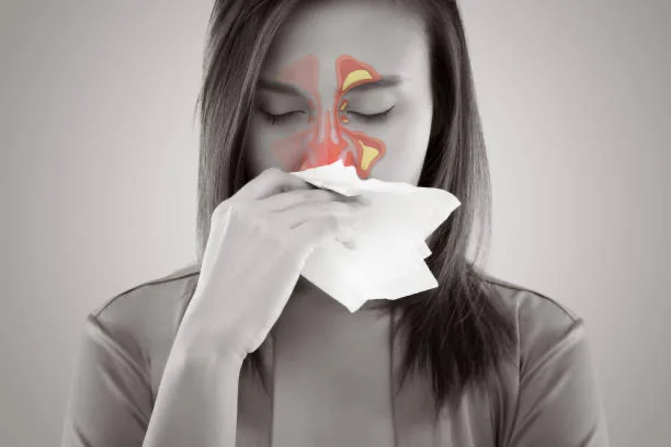 Nasal blockage - Congestion 