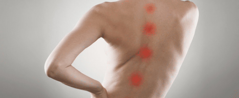 Spinal Alignment